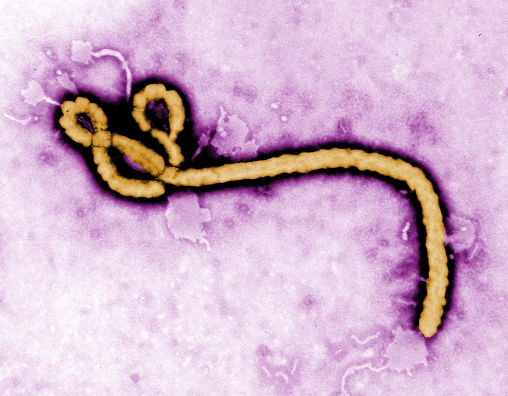 140727-ebola-jms-2109 f8eada30a725d312b7c5791a8f9fd5e8-1024x798