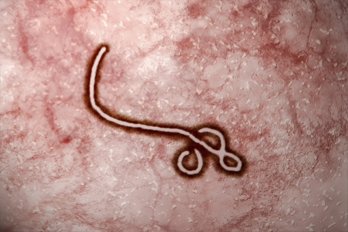 ebola23454